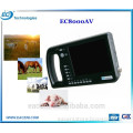 Factory Price veterinary endoscope/rigid scope /laptop ultrasound for EC8000AV